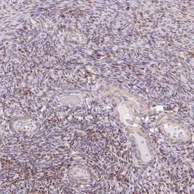 Immunohistochemistry-Paraffin MUM1L1 Antibody - BSA Free