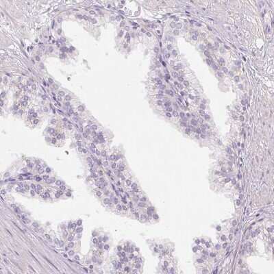Immunohistochemistry-Paraffin MUM1L1 Antibody - BSA Free