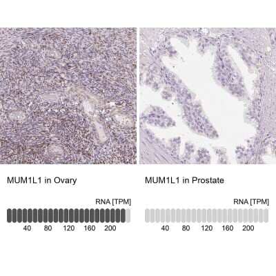 Immunohistochemistry-Paraffin MUM1L1 Antibody - BSA Free