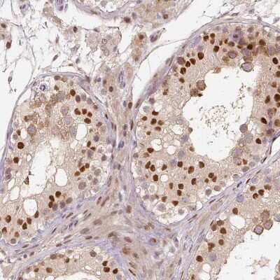 Immunohistochemistry-Paraffin MUM1L1 Antibody - BSA Free