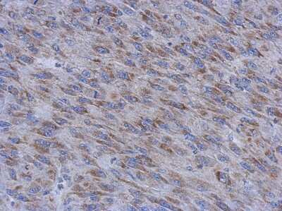 Immunohistochemistry-Paraffin MUM1L1 Antibody
