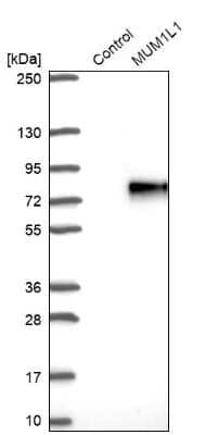 Western Blot MUM1L1 Antibody - BSA Free
