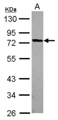 Western Blot MUM1L1 Antibody