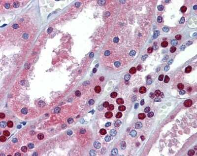 Immunohistochemistry-Paraffin MUPP1 Antibody