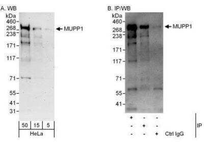 Western Blot: MUPP1 Antibody [NBP1-49974] - Detection of Human MUPP1 by Western Blot and Immunoprecipitation.  Samples: Whole cell lysate (5, 15 and 50 mcg for WB; 1 mg for IP, 20% of IP loaded) from HeLa cells.  Antibodies: Affinity purified rabbit anti-MUPP1 antibody used for WB at 0.1 mcg/ml (A) and 1 mcg/ml (B) and used for IP at 3 mcg/mg lysate.  MUPP1 was also immunoprecipitated by rabbit anti-MUPP1 antibody which recognizes a downstream epitope.  For blotting immunoprecipitated MUPP1 was used. Detection: Chemiluminescence with exposure times of 3 minutes (A and B).