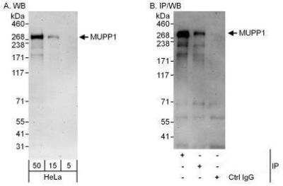 Western Blot: MUPP1 Antibody [NBP1-49975] - Detection of Human MUPP1 by Western Blot and Immunoprecipitation.  Samples: Whole cell lysate (5, 15 and 50 mcg for WB; 1 mg for IP, 20% of IP loaded) from HeLa cells.  Antibodies: Affinity purified rabbit anti-MUPP1 antibody used for WB at 0.1 mcg/ml (A) and 1 mcg/ml (B) and used for IP at 3 mcg/mg lysate.  MUPP1 was also immunoprecipitated by rabbit anti-MUPP1 antibody which recognizes an upstream epitope.  For blotting immunoprecipitated MUPP1 was used.  Detection: Chemiluminescence with exposure times of 3 minutes (A and B).