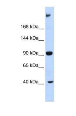 Western Blot MUPP1 Antibody