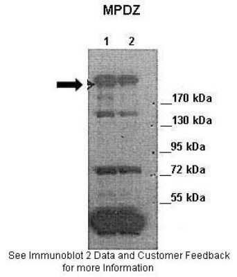 Western Blot MUPP1 Antibody