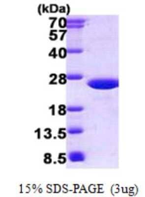 SDS-PAGE Recombinant Mouse MUP-1 His Protein