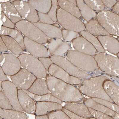 Immunohistochemistry-Paraffin: MURC Antibody [NBP1-86607] - Staining of human skeletal muscle shows high expression.