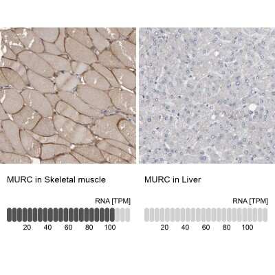 <b>Orthogonal Strategies Validation. </b>Immunohistochemistry-Paraffin: MURC Antibody [NBP1-86607] - Staining in human skeletal muscle and liver tissues using anti-MURC antibody. Corresponding MURC RNA-seq data are presented for the same tissues.