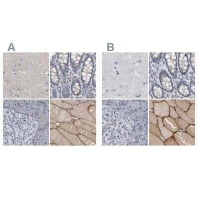 <b>Independent Antibodies Validation. </b>Immunohistochemistry-Paraffin: MURC Antibody [NBP1-86607] - Staining of human cerebral cortex, colon, pancreas and skeletal muscle using Anti-MURC antibody NBP1-86607 (A) shows similar protein distribution across tissues to independent antibody NBP1-86609 (B).