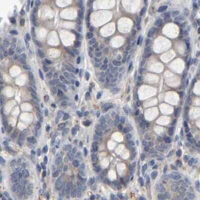 Immunohistochemistry-Paraffin: MURC Antibody [NBP1-86607] - Staining of human colon.