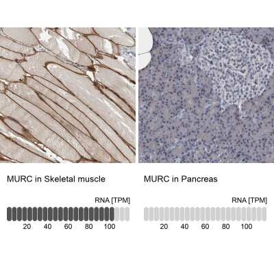 <b>Orthogonal Strategies Validation. </b>Immunohistochemistry-Paraffin: MURC Antibody [NBP1-86608] - Staining in human skeletal muscle and pancreas tissues using anti-MURC antibody. Corresponding MURC RNA-seq data are presented for the same tissues.