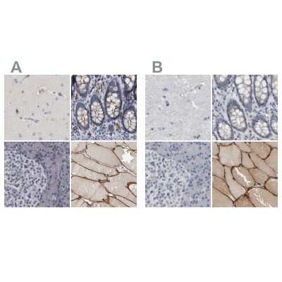 <b>Independent Antibodies Validation. </b>Immunohistochemistry-Paraffin: MURC Antibody [NBP1-86608] - Staining of human cerebral cortex, colon, pancreas and skeletal muscle using Anti-MURC antibody NBP1-86608 (A) shows similar protein distribution across tissues to independent antibody NBP1-86609 (B).