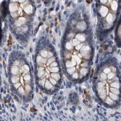 Immunohistochemistry-Paraffin: MURC Antibody [NBP1-86608] - Staining of human colon.