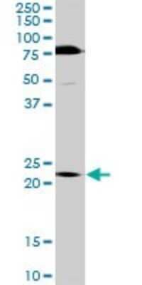 Western Blot: MURF2 Antibody [H00084675-D01P] - Analysis of TRIM55 expression in mouse kidney.