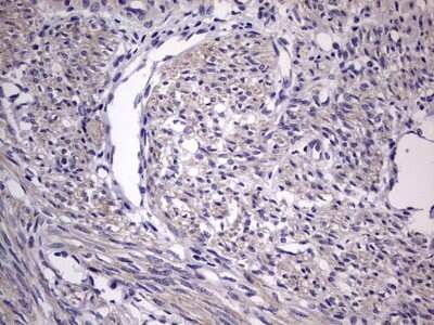 Immunohistochemistry: MURF3 Antibody (7F8) [NBP2-46224] - Analysis of Human endometrium tissue.