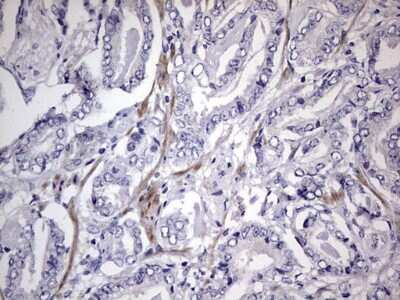 Immunohistochemistry: MURF3 Antibody (7F8) [NBP2-46224] - Analysis of Human prostate tissue.