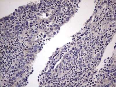 Immunohistochemistry: MURF3 Antibody (7F8) [NBP2-46224] - Analysis of Human lymph node tissue.