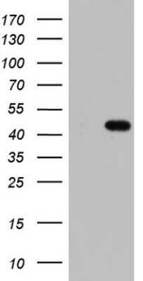 Western Blot: MURF3 Antibody (OTI7F8) - Azide and BSA Free [NBP2-72827] - Analysis of HEK293T cells were transfected with the pCMV6-ENTRY control (Left lane) or pCMV6-ENTRY MURF3.