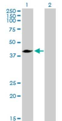 Western Blot: MVD Antibody [H00004597-D01P] - Analysis of MVD expression in transfected 293T cell line by MVD polyclonal antibody.Lane 1: MVD transfected lysate(43.40 KDa).Lane 2: Non-transfected lysate.