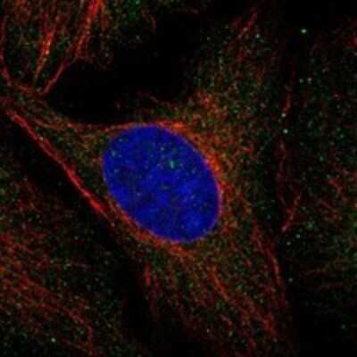 Immunocytochemistry/Immunofluorescence: MVK Antibody [NBP3-17741] - Staining of human cell line U-2 OS shows localization to cytosol & vesicles.