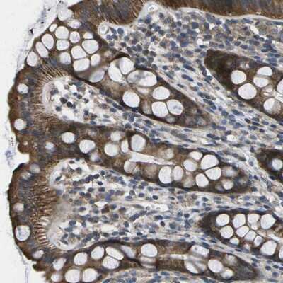 Immunohistochemistry-Paraffin: MVK Antibody [NBP1-82824] - Staining of human rectum shows strong cytoplasmic positivity in glandular cells.