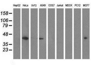 Western Blot: MVK Antibody (OTI 1D7) - Azide and BSA Free [NBP2-72837] - Analysis of extracts (35ug) from 9 different cell lines by using anti-MVK monoclonal antibody (HepG2: human; HeLa: human; SVT2: mouse; A549: human; COS7: monkey; Jurkat: human; MDCK: canine; PC12: rat; MCF7: human).