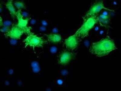 Immunocytochemistry/Immunofluorescence: MVK Antibody (OTI 1D7) [NBP2-00775] - Staining of COS7 cells transiently transfected by pCMV6-ENTRY MVK.