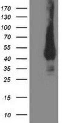 Western Blot: MVK Antibody (OTI 1D7) [NBP2-00775] - HEK293T cells were transfected with the pCMV6-ENTRY control (Left lane) or pCMV6-ENTRY MVK (Right lane) cDNA for 48 hrs and lysed. Equivalent amounts of cell lysates (5 ug per lane) were separated by SDS-PAGE and immunoblotted with anti-MVK.