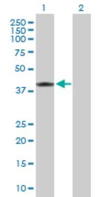 Western Blot: MVK Antibody [H00004598-D01P] - Analysis of MVK expression in transfected 293T cell line by MVK polyclonal antibody.Lane 1: MVK transfected lysate(42.50 KDa).Lane 2: Non-transfected lysate.