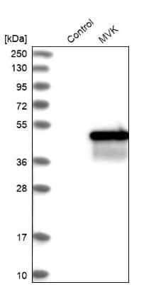 Western Blot MVK Antibody