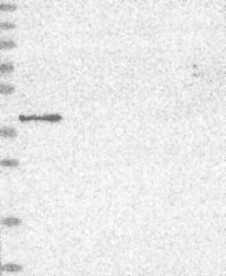 Western Blot: MVK Antibody [NBP3-17741] - Lane 1: Marker [kDa] 250, 130, 95, 72, 55, 36, 28, 17, 10;   Lane 2: RT4;   Lane 3: U-251 MG