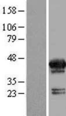 Western Blot MVK Overexpression Lysate