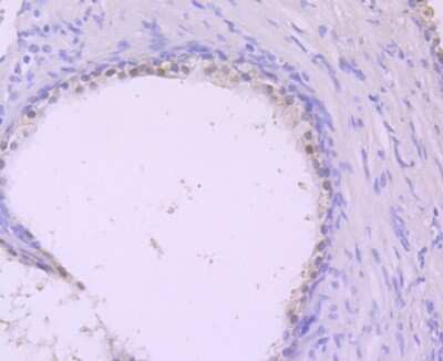 Immunohistochemistry-Paraffin: MVP Antibody (JM53-18) [NBP2-75471] - Analysis of paraffin-embedded human prostate tissue using anti-DDAH1 antibody. Counter stained with hematoxylin.