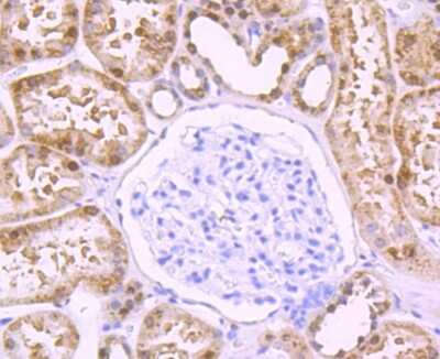Immunohistochemistry-Paraffin: MVP Antibody (JM53-18) [NBP2-75471] - Analysis of paraffin-embedded human kidney tissue using anti-DDAH1 antibody. Counter stained with hematoxylin.
