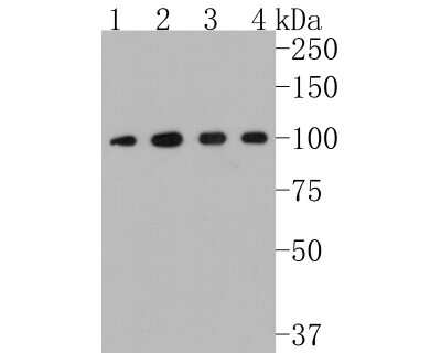 Western Blot: MVP Antibody (JM74-73) [NBP2-75579] - Western blot analysis of MVP on different lysates. Proteins were transferred to a PVDF membrane and blocked with 5% BSA in PBS for 1 hour at room temperature. The primary antibody (1/500) was used in 5% BSA at room temperature for 2 hours. Goat Anti-Rabbit IgG - HRP Secondary Antibody (HA1001) at 1:5,000 dilution was used for 1 hour at room temperature. Positive control: Lane 1: A549 cell lysate Lane 2: PC-12 cell lysate Lane 3: Hela cell lysate Lane 4: mouse kidney tissue lysate