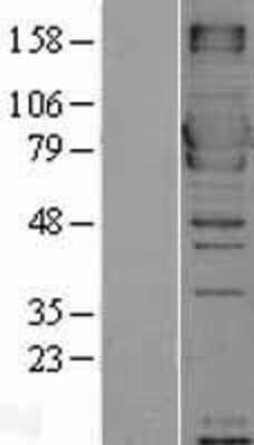 Western Blot: MX1 Overexpression Lysate (Adult Normal) [NBL1-13404] Left-Empty vector transfected control cell lysate (HEK293 cell lysate); Right -Over-expression Lysate for MX1.