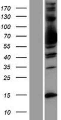 Western Blot: MX1 Overexpression Lysate (Adult Normal) [NBP2-09716] Left-Empty vector transfected control cell lysate (HEK293 cell lysate); Right -Over-expression Lysate for MX1.