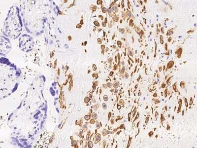Immunohistochemistry-Paraffin: MXRA7 Antibody [NBP3-06326] - Immunochemical staining of human MXRA7 in human placenta with rabbit polyclonal antibody at 1:2000 dilution, formalin-fixed paraffin embedded sections.