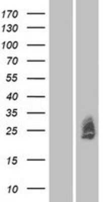 Western Blot: MXRA7 Overexpression Lysate (Adult Normal) [NBP2-08810] Left-Empty vector transfected control cell lysate (HEK293 cell lysate); Right -Over-expression Lysate for MXRA7.