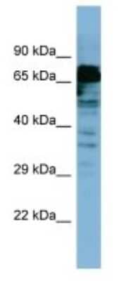 Western Blot: MYB Antibody [NBP3-10890] - Western blot analysis of MYB in OVCAR-3 Whole Cell lysates. Antibody dilution at 1.0ug/ml