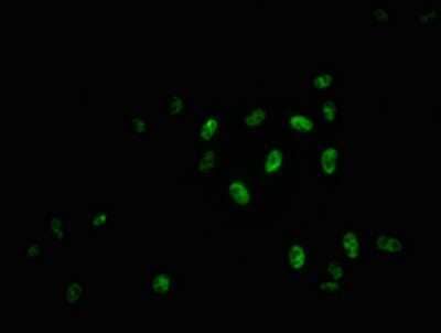 Immunocytochemistry/Immunofluorescence: MYB [p Ser11] Antibody (3F4) [NBP3-15214] - Immunofluorescence staining of Hela cells with MYB antibody at 1:100, counter-stained with DAPI. The cells were fixed in 4% formaldehyde, permeabilized using 0.2% Triton X-100 and blocked in 10% normal Goat Serum. The cells were then incubated with the antibody overnight at 4C. The secondary antibody was Alexa Fluor 488-congugated Goat Anti-Rabbit IgG (H+L).