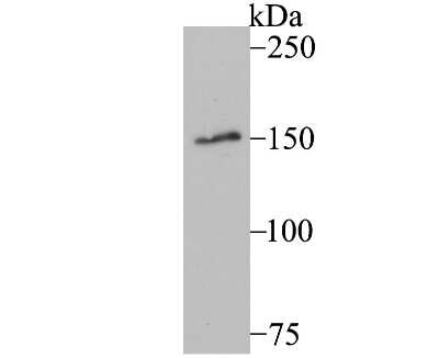 Western Blot: MYBBP1A Antibody (JB40-09) [NBP2-75580] - Analysis of MYBBP1A on A549 cell using anti-MYBBP1A antibody at 1/500 dilution.