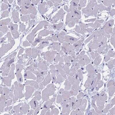 Immunohistochemistry-Paraffin MYBPC2 Antibody - BSA Free