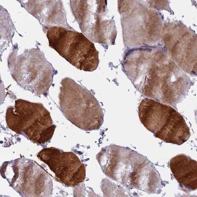 Immunohistochemistry-Paraffin MYBPC2 Antibody - BSA Free
