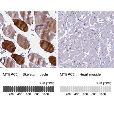 Immunohistochemistry-Paraffin MYBPC2 Antibody - BSA Free