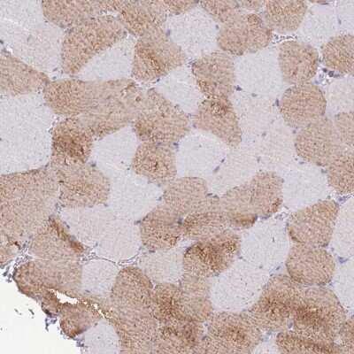 Immunohistochemistry-Paraffin MYBPC2 Antibody - BSA Free