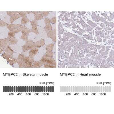 Immunohistochemistry-Paraffin MYBPC2 Antibody - BSA Free